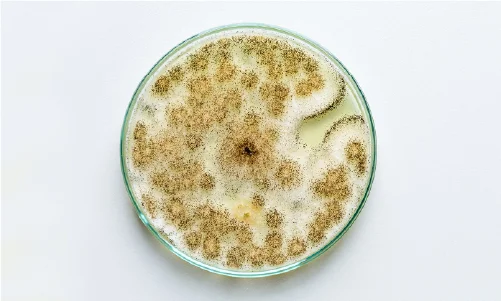 Control microbiologico 1